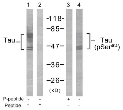 Rabbit Anti Tau (Phospho-Ser404) pAb Western blot analysis Rabbit Anti Tau (Phospho-Ser404) pAb Western blot analysis