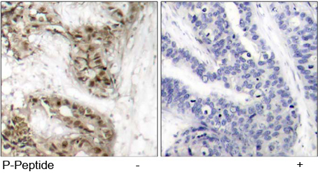 Rabbit Anti cdc25C (Phospho-Ser216) pAb Immunohistochemical analysis Rabbit Anti cdc25C (Phospho-Ser216) pAb Immunohistochemical analysis