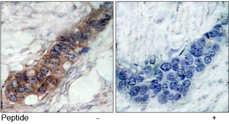 Rabbit Anti JAK2 (Ab-221) pAb Immunohistochemical analysis Rabbit Anti JAK2 (Ab-221) pAb Immunohistochemical analysis