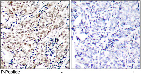Rabbit Anti Chk1 (Phospho-Ser345) pAb Immunohistochemical analysis Rabbit Anti Chk1 (Phospho-Ser345) pAb Immunohistochemical analysis
