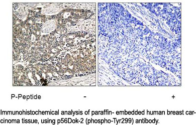Immunohistochemical analysis using p56Dok-2 (Phospho-Tyr299) Antibody