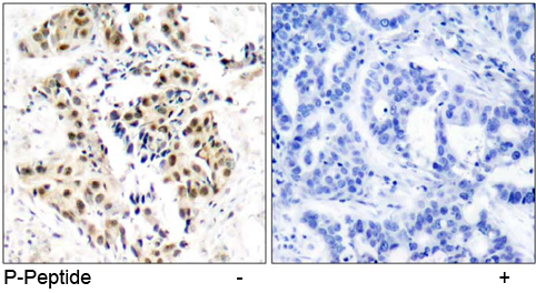Rabbit Anti ATM (Phospho-Ser1981) pAb Immunohistochemical analysis Rabbit Anti ATM (Phospho-Ser1981) pAb Immunohistochemical analysis