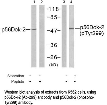 Western blot analysis using p56Dok-2 (Phospho-Tyr299) Antibody