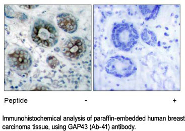 Immunohistochemical analysis using GAP43 (Ab-41) Antibody