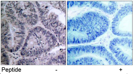 Rabbit Anti IKKα (Ab-23) pAb Immunohistochemical analysis