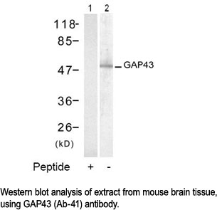 Western blot analysis using GAP43 (Ab-41) Antibody