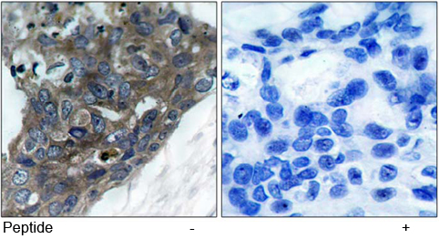 Rabbit Anti ASK1 (Ab-966) pAb Immunohistochemical analysis