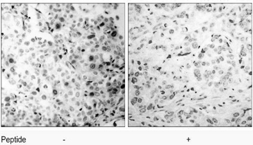 Rabbit Anti CDK2 (Phospho-Thr160) pAb Immunohistochemical analysis Rabbit Anti CDK2 (Phospho-Thr160) pAb Immunohistochemical analysis