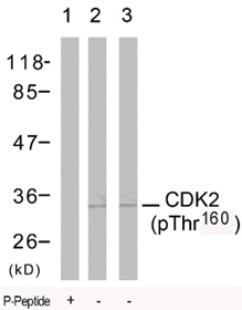 Rabbit Anti CDK2 (Phospho-Thr160) pAb Western blot analysis Rabbit Anti CDK2 (Phospho-Thr160) pAb Western blot analysis