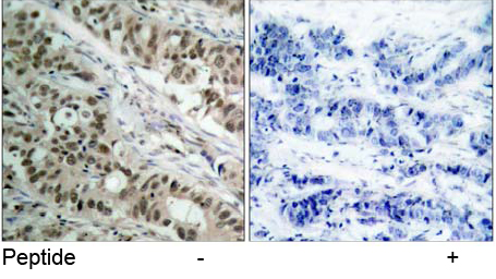 Rabbit Anti-FKHR (Ab-256) Polyclonal Antibody IHC