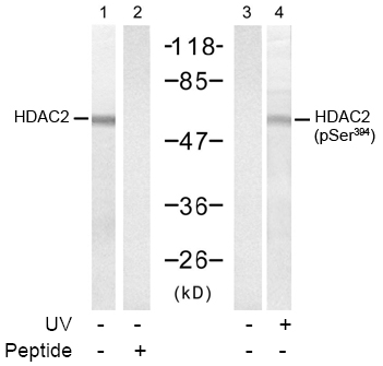 Rabbit Anti-HDAC2 (Ab-394) polyclonal antibody Rabbit Anti-HDAC2 (Ab-394) polyclonal antibody