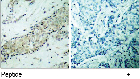 Rabbit Anti HDAC5 (Ab-498) pAb Immunohistochemical analysis
