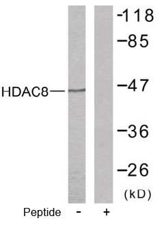 Rabbit Anti HDAC5 (Ab-498) pAb Western blot analysis Rabbit Anti HDAC5 (Ab-498) pAb Western blot analysis