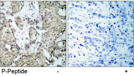 Rabbit Anti MKK3 (Phospho-Ser189) pAb Immunohistochemical analysis