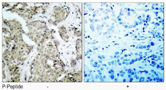 Rabbit Anti MKK6 (Phospho-Ser207) pAb Immunohistochemical analysis Rabbit Anti MKK6 (Phospho-Ser207) pAb Immunohistochemical analysis