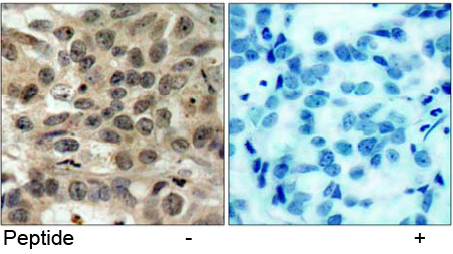 Rabbit Anti cdc25C (Ab-216) pAb Immunohistochemical analysis Rabbit Anti cdc25C (Ab-216) pAb Immunohistochemical analysis