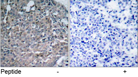Rabbit Anti FAK (Ab-925) pAb Immunohistochemical analysis Rabbit Anti FAK (Ab-925) pAb Immunohistochemical analysis