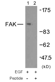 Rabbit Anti FAK (Ab-925) pAb Western blot analysis Rabbit Anti FAK (Ab-925) pAb Western blot analysis