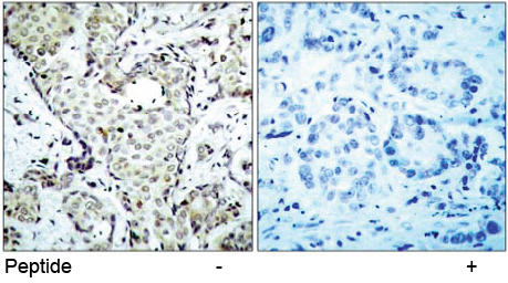 Rabbit Anti MKK6 (Ab-207) pAb Immunohistochemical analysis Rabbit Anti MKK6 (Ab-207) pAb Immunohistochemical analysis