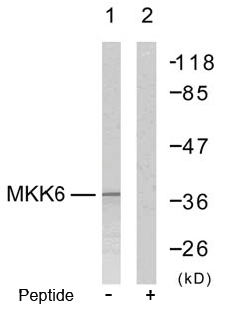 Rabbit Anti MKK6 (Ab-207) pAb Western blot analysis Rabbit Anti MKK6 (Ab-207) pAb Western blot analysis