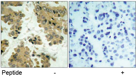 Rabbit Anti Akt2 (Ab-474) pAb Immunohistochemical analysis Rabbit Anti Akt2 (Ab-474) pAb Immunohistochemical analysis