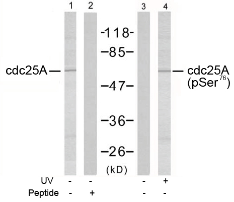 Rabbit Anti cdc25A (Ab-75) pAb Western blot analysis