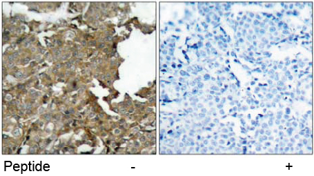 Rabbit Anti-Cofilin (Ab-3) pAb Immunohistochemical analysis