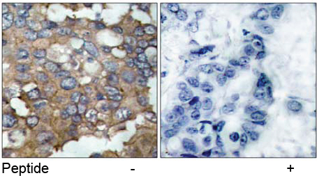 Rabbit Anti Src (Ab-529) pAb Immunohistochemical analysis Rabbit Anti Src (Ab-529) pAb Immunohistochemical analysis