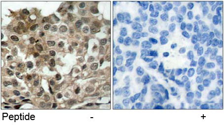 Rabbit Anti FKHRL1 (Ab-253) pAb Immunohistochemical analysis Rabbit Anti FKHRL1 (Ab-253) pAb Immunohistochemical analysis