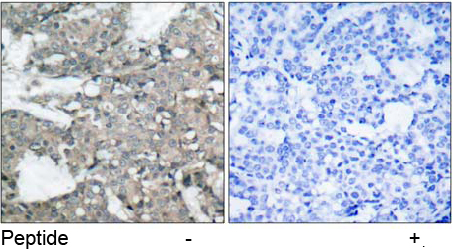 Rabbit Anti-MEK1 (Ab-221) Polyclonal Antibody IHC Rabbit Anti-MEK1 (Ab-221) Polyclonal Antibody IHC