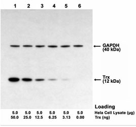 One-Step Multiplex Western<sup>TM</sup> Blot performed using mouse monoclonal antibody