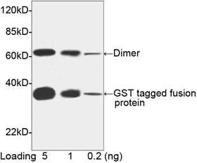 Western Analysis using Mouse Anti GST Monoclonal Antibody [Biotin] (A00867)