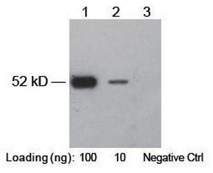Rabbit anti-KT3 polyclonal antibody [HRP]