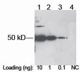 Rabbit Anti-Xpress-tag Polyclonal Antibody western blot analysis Rabbit Anti-Xpress-tag Polyclonal Antibody western blot analysis
