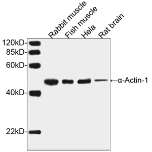 Rabbit Anti-α-Actin-1 Polyclonal Antibody, one-step western blot analysis Rabbit Anti-α-Actin-1 Polyclonal Antibody, one-step western blot analysis