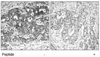abbit Anti-Shc1 (Ab-427) Polyclonal Antibody IHC Rabbit Anti-Shc1 (Ab-427) Polyclonal Antibody IHC
