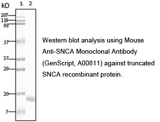 Western blot analysis using Mouse Anti-SNCA Monoclonal Antibody
