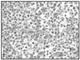 Immunohistochemical analysis using Mouse Anti-SNCA Monoclonal Antibody
title=