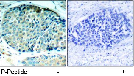Immunohistochemical analysis using Rabbit Anti-HSP27 (Phospho-Ser78) Polyclonal Antibody