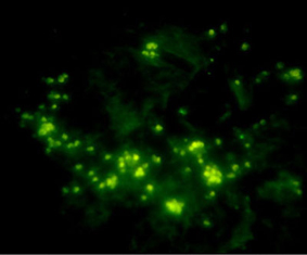Immunofluorescent analysis Immunofluorescent analysis