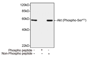 Rabbit Anti-Akt (Phospho-Ser473) Polyclonal Antibody Rabbit Anti-Akt (Phospho-Ser473) Polyclonal Antibody