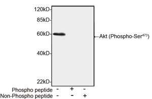 Rabbit Anti-Akt (Phospho-Ser473) Polyclonal Antibody Rabbit Anti-Akt (Phospho-Ser473) Polyclonal Antibody