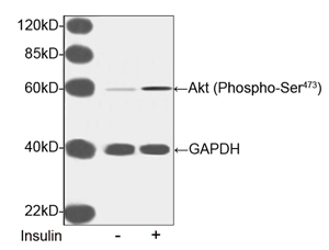 Rabbit Anti-Akt (Phospho-Ser473) Polyclonal Antibody Rabbit Anti-Akt (Phospho-Ser473) Polyclonal Antibody