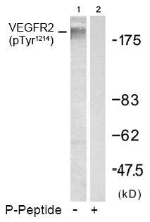 Rabbit Anti-VEGFR2 (Phospho-Tyr1214) Polyclonal Antibody WB Rabbit Anti-VEGFR2 (Phospho-Tyr1214) Polyclonal Antibody WB