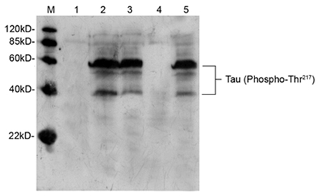 Rabbit Anti-Tau (Phospho-Thr217) Polyclonal Antibody Rabbit Anti-Tau (Phospho-Thr217) Polyclonal Antibody