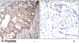 Rabbit Anti-Shc1 (Phospho-Tyr427) Polyclonal Antibody IHC