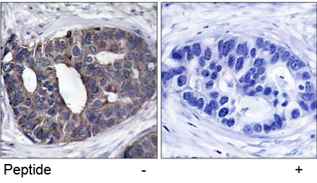 Rabbit Anti-p62Dok (Ab-362) Polyclonal Antibody IHC