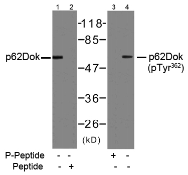 Rabbit Anti-p62Dok (Ab-362) Polyclonal Antibody WB