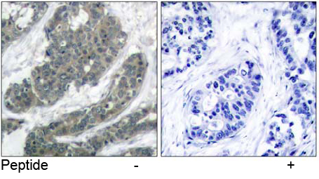 Rabbit Anti-p62Dok (Ab-398) Polyclonal Antibody IHC