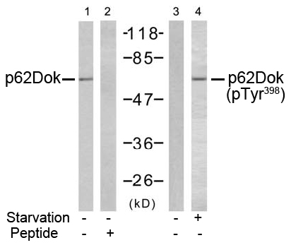 Rabbit Anti-p62Dok (Ab-398) Polyclonal Antibody WB